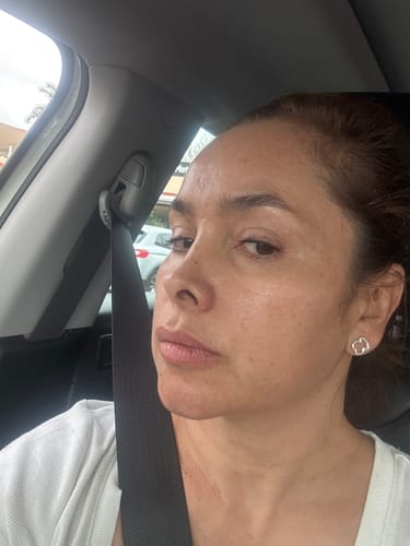 Customer photo review of Combo Adiós Manchas y Líneas