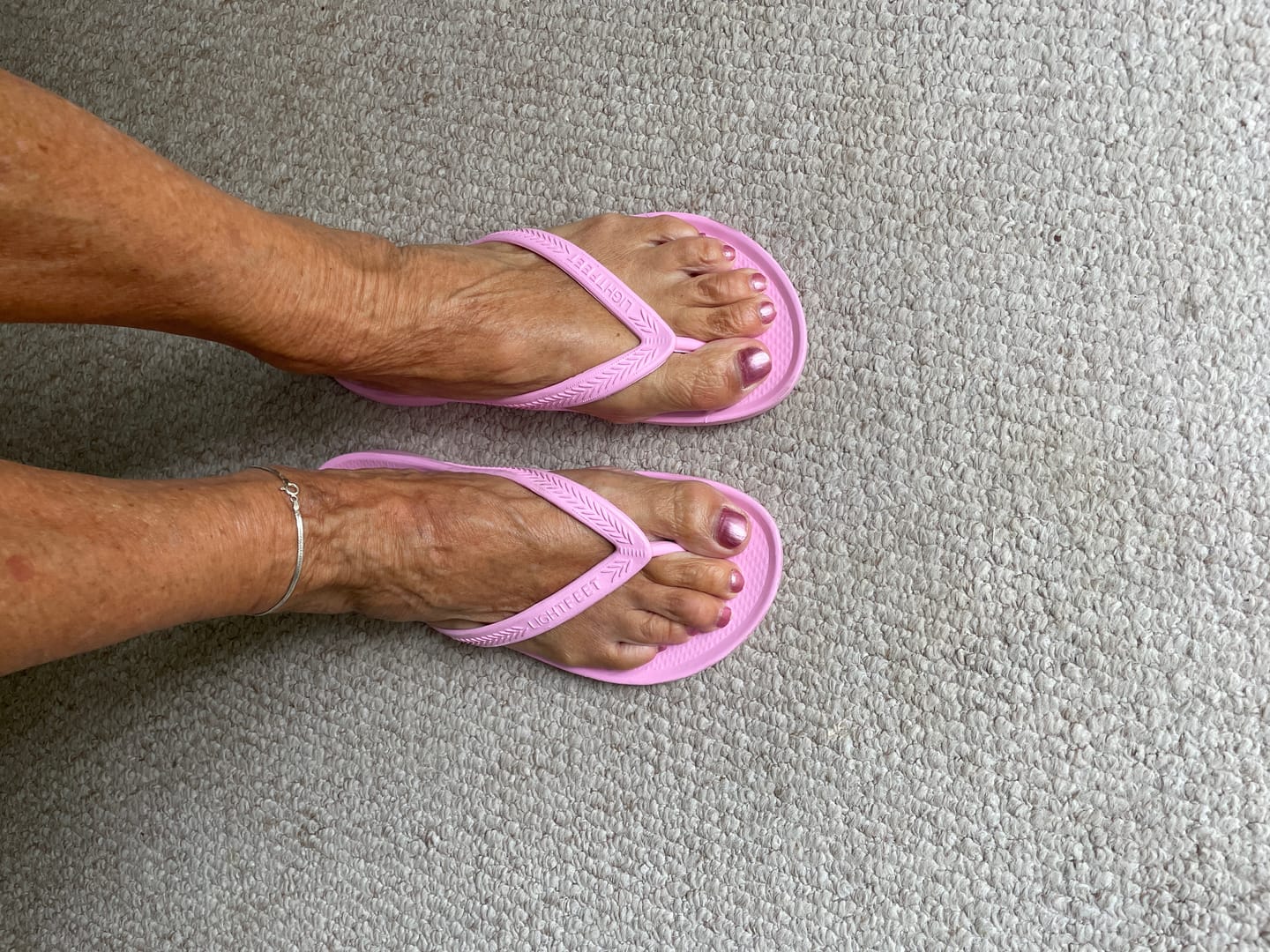Customer photo review of Pink - Arch Support Flip Flops