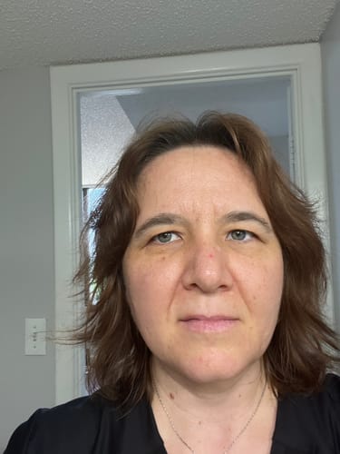 Customer photo review of Grass Fed Tallow & Honey Balm