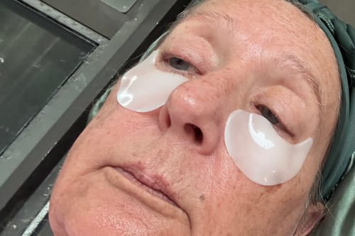 Customer photo review of Glov Micro Infusion System