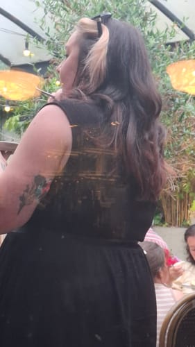 Customer photo review of Skin Grip Original - Dexcom G7 & Stelo Adhesive Patches