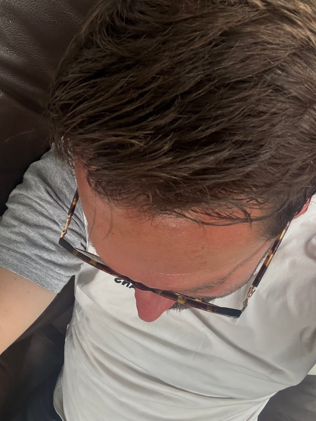Customer photo review of LIVDOR Pro Laser Hair Growth Cap