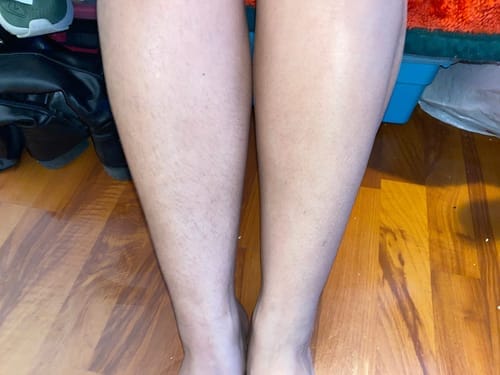 Customer photo review of SuaviPro™