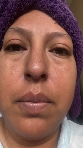 Customer photo review of Combo Rejuvenecimiento Profundo