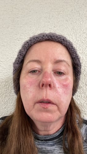 Customer photo review of The Super Glo Hydro Boost Jelly Moisturiser