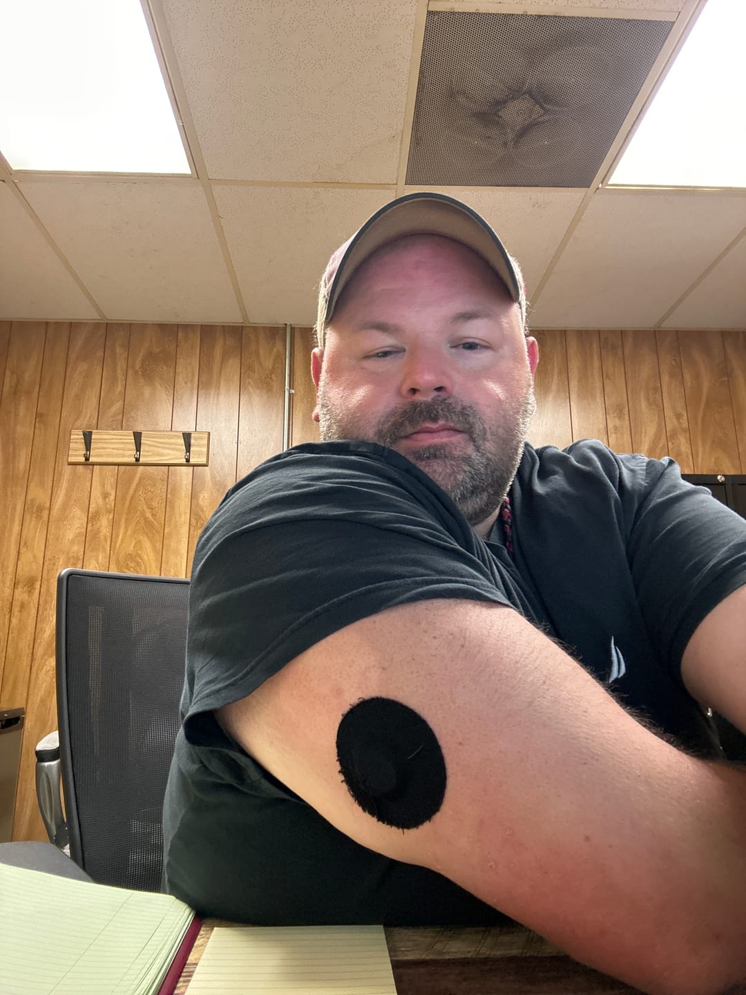 Customer photo review of Skin Grip Original - Dexcom G7 & Stelo Adhesive Patches