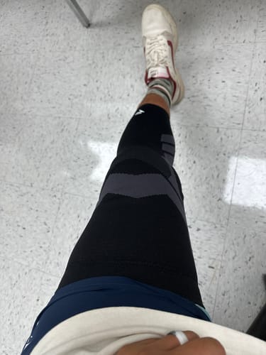 Customer photo review of Compression Sleeves V2 for Knees and Legs