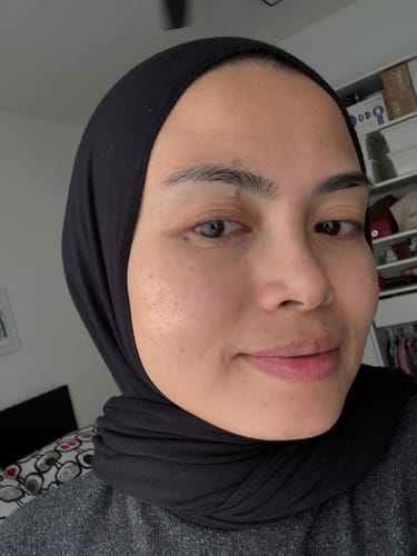 Customer photo review of 7HA Peptide Intensive Hydration Serum