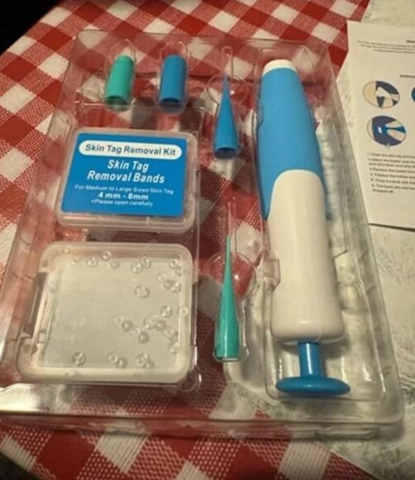 Customer photo review of ALCURA™ Komplett Set Bundle