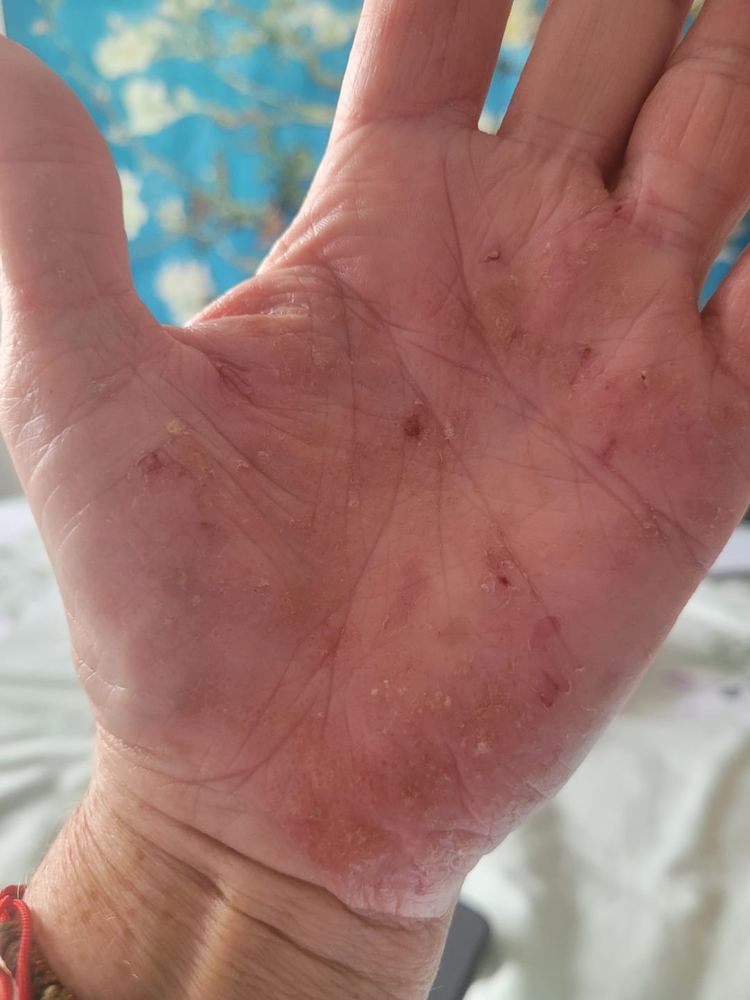 Customer photo review of Bioskin Duo Pack