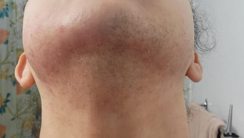 Customer photo review of Silvra™ - Cyperus Rotundus hudserum