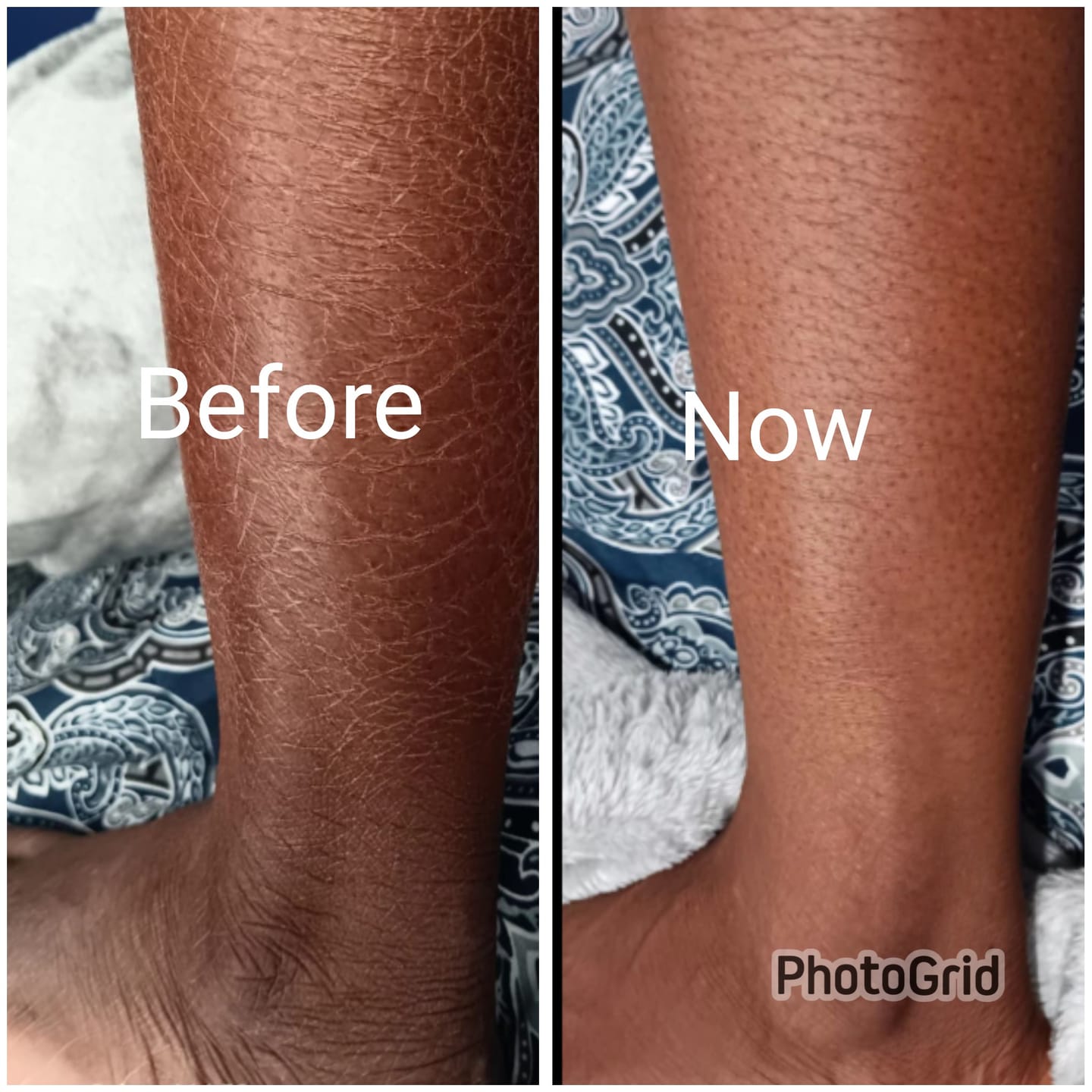 Customer photo review of Anti-Aging Moisturizing Body Lotion
