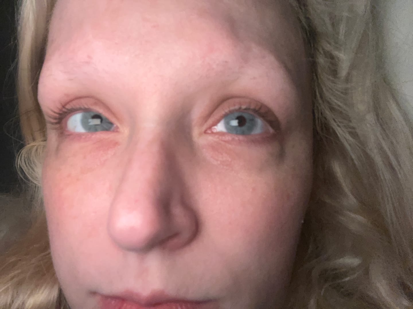 Customer photo review of Clover Blue Prescription Colored Contact Lenses