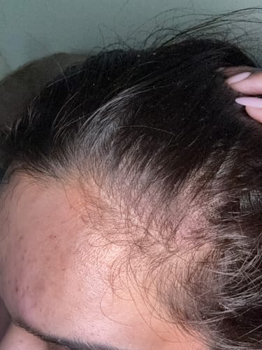 Customer photo review of Seb Natural Calming Serum