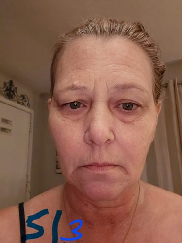 Customer photo review of Zoyava Soothe and Smooth Bundle: Cortisol 60 and Myo-Inositol 90 Capsules Supplement Bundle