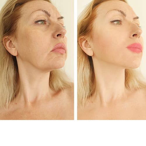 Customer photo review of CollaGlow by K7