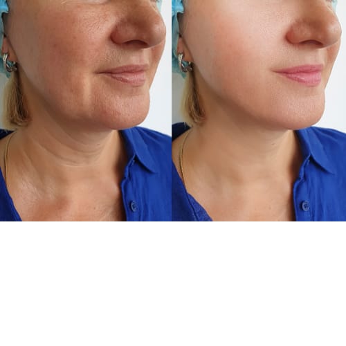 Customer photo review of CollaGlow by K7