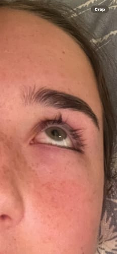 Customer photo review of LASH SERUM