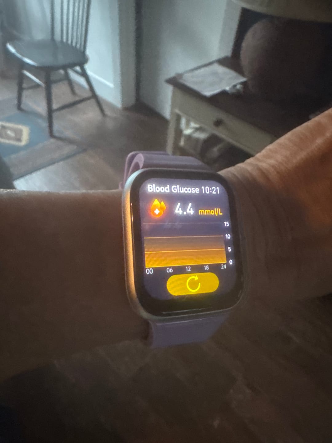 Customer photo review of BEARSCOME Blood Pressure Blood oxygen Blood Sugar Monitoring Bluetooth Talk Play Music Health Waterproof Smartwatch