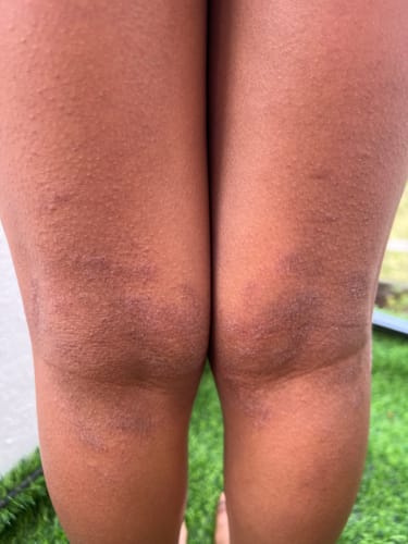 Customer photo review of Calm Balm