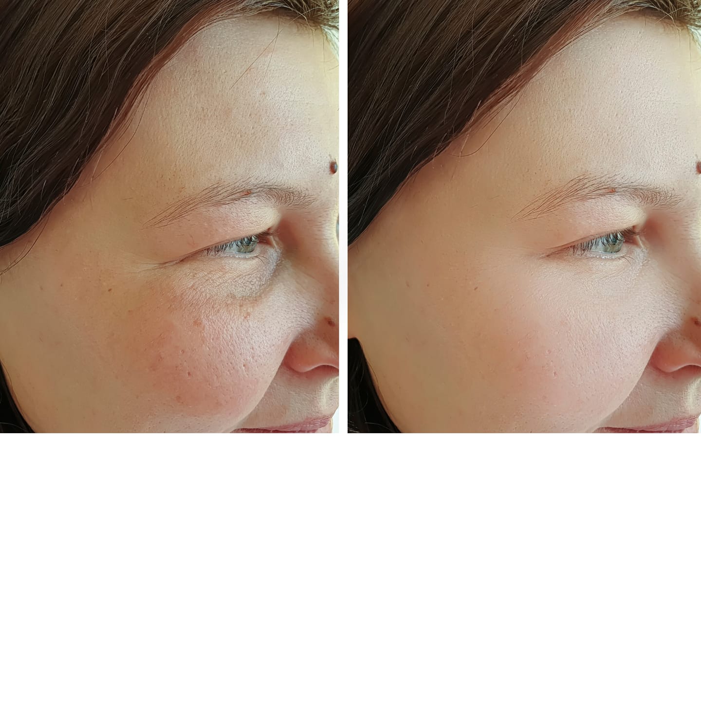 Customer photo review of CollaGlow by K7