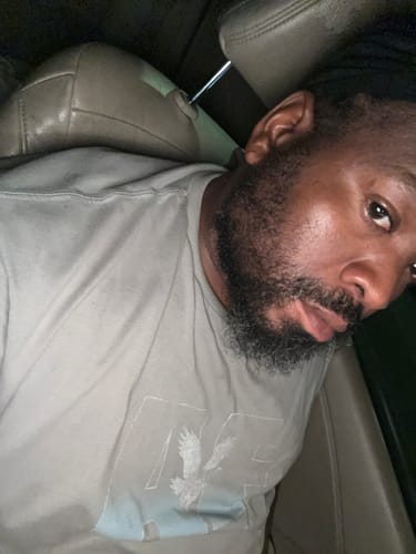 Customer photo review of Two Bottles of Rennora Hair Growth Serum