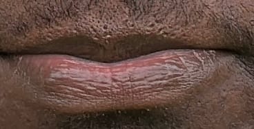 Customer photo review of Lips Lightening Cream For Men and Women (Results in 5 Days or Less)