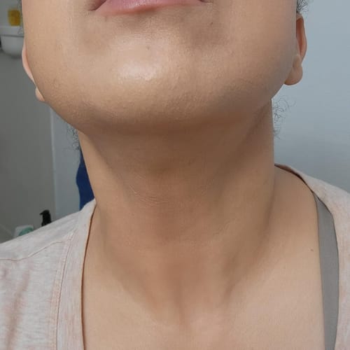 Customer photo review of Silvra™ - Cyperus Rotundus hudserum