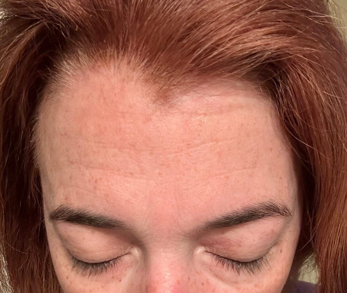 Customer photo review of The Complete System for Mature Women’s Skin
