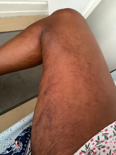 Customer photo review of Rituel : Soin revitalisant vergeture