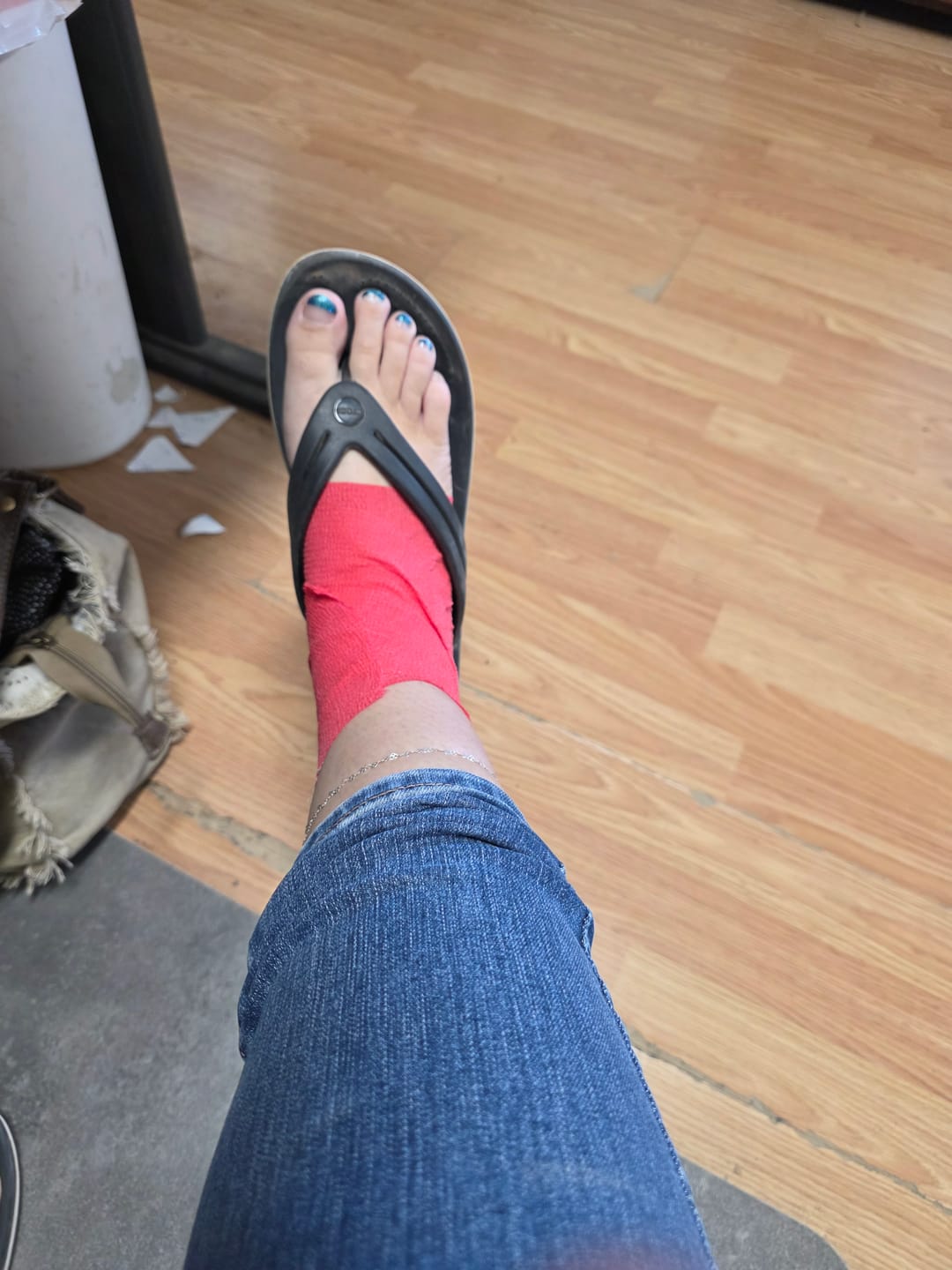 Customer photo review of Icee Tape - Cooling Athletic Tape