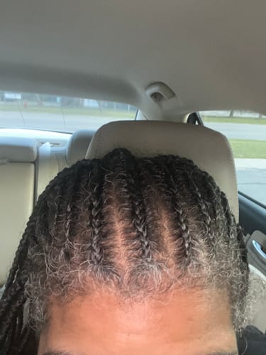 Customer photo review of Herbal Hair Growth Oil