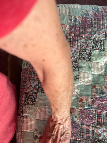 Customer photo review of Self Tanning 150 Capsules