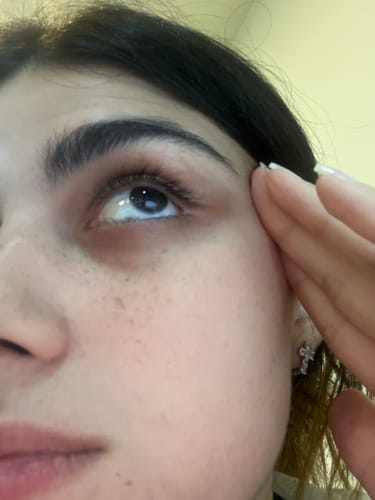 Customer photo review of Lanbena Eyelash Growth Serum