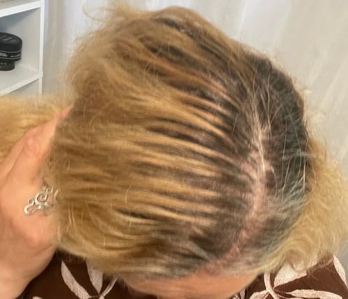 Customer photo review of Sunkissed Starter Kit