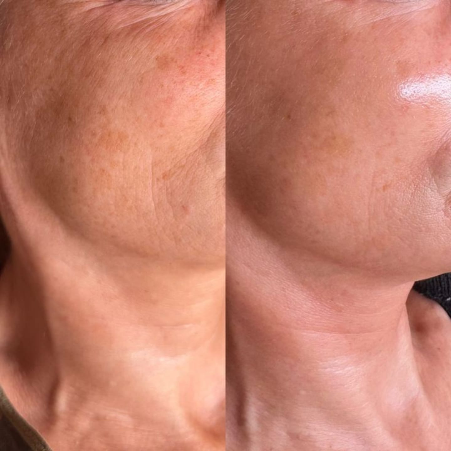 Customer photo review of NeoCell Bio Serum