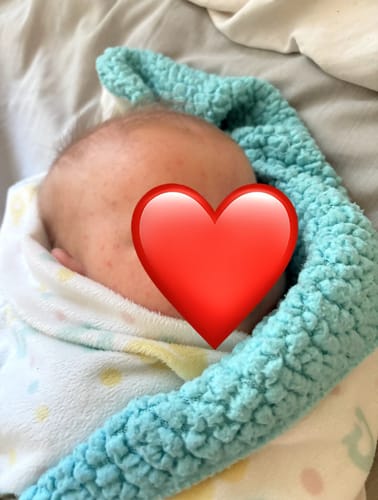 Customer photo review of All Over Ointment Eczema Treatment