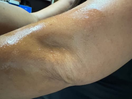 Customer photo review of Pain Relief Rub Roll-On 1000/2000/5000Mg CBD 3 Oz.