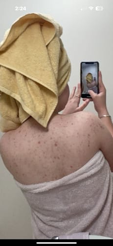 Customer photo review of Exfoli-YAY Body Wash