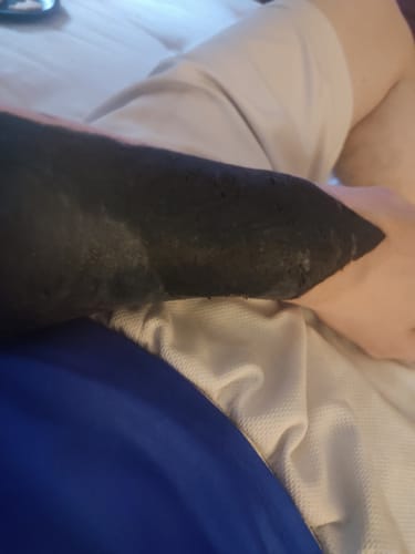 Customer photo review of TattooNumbx Numbing Cream
