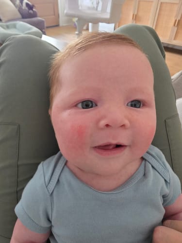 Customer photo review of All Over Ointment Eczema Treatment