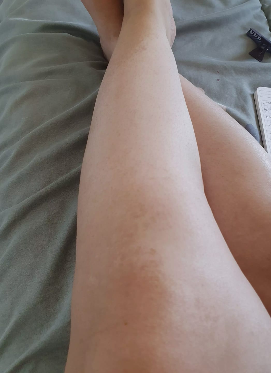 Customer photo review of Épilation Définitive Professionnelle à la Lumière Pulsée IPL™