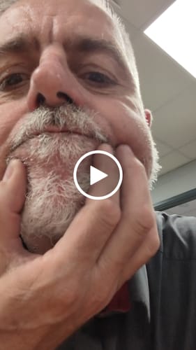 Customer video review of Seb Natural Calming Serum