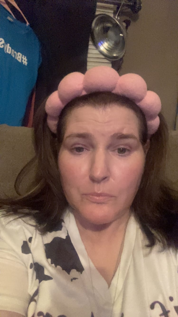 Customer photo review of Coconut Lip Mask