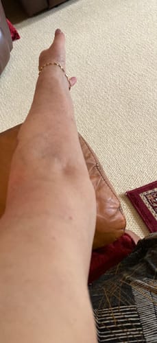 Customer photo review of Besque™ Magic Body Oil - 100ml