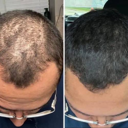 Customer crown coverage