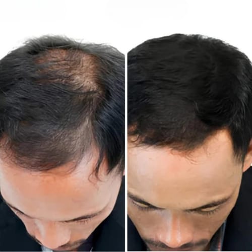 Customer crown progress