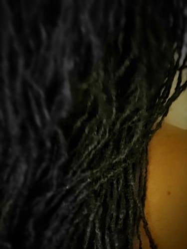 Customer photo review of Rennora Hair Growth Serum