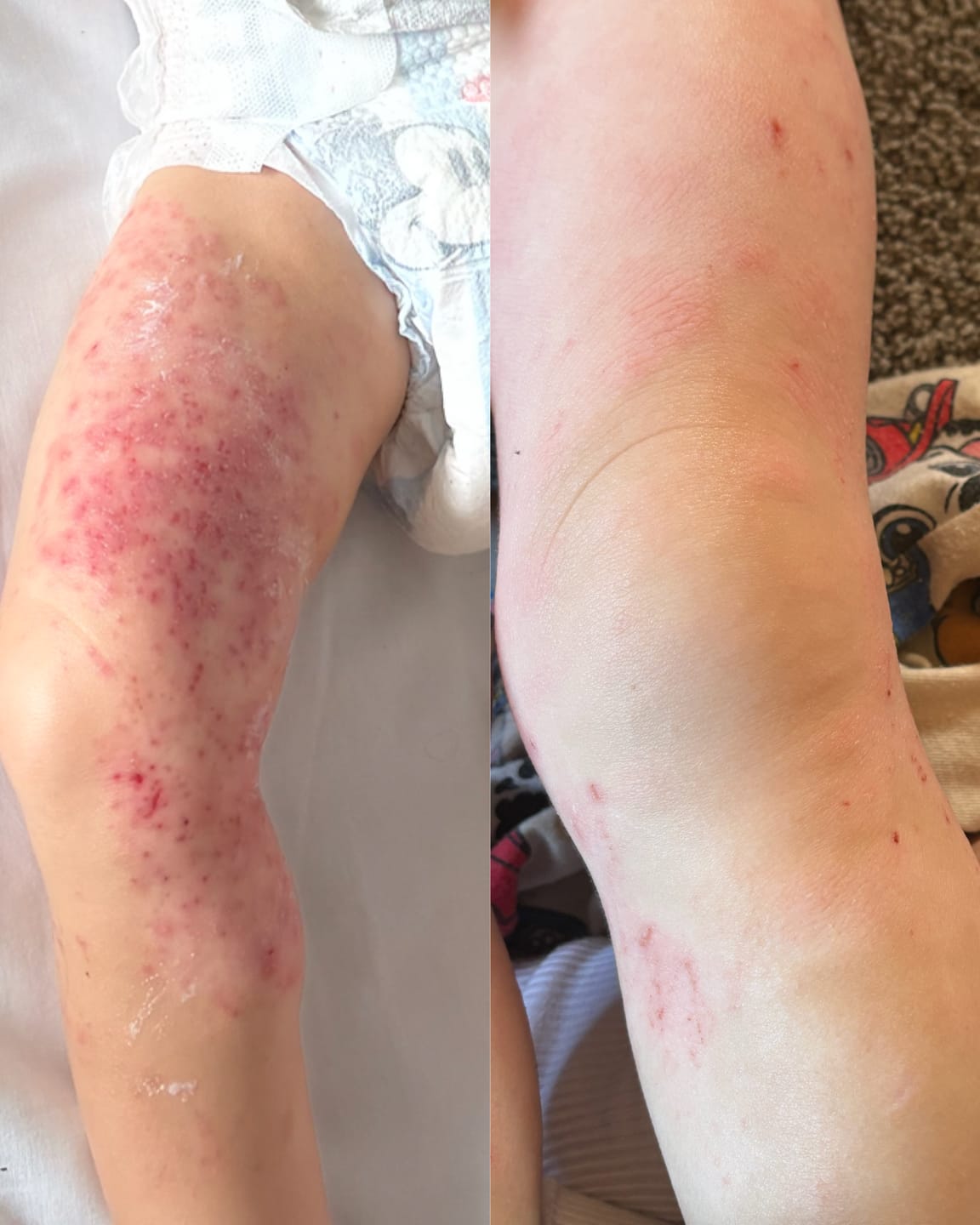 Customer photo review of Kawakawa Repair Balm - Winner, Best SOS/Healing Balm 2024