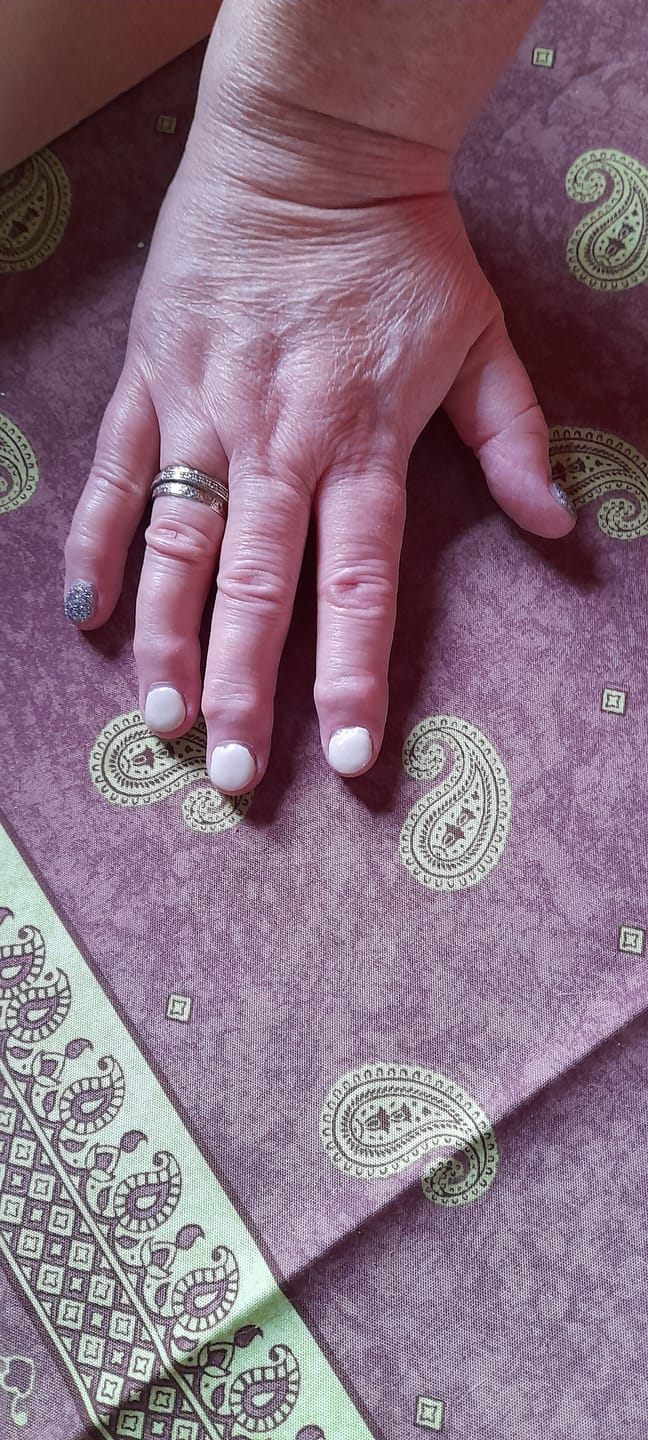 Customer photo review of Nagelriemolie
